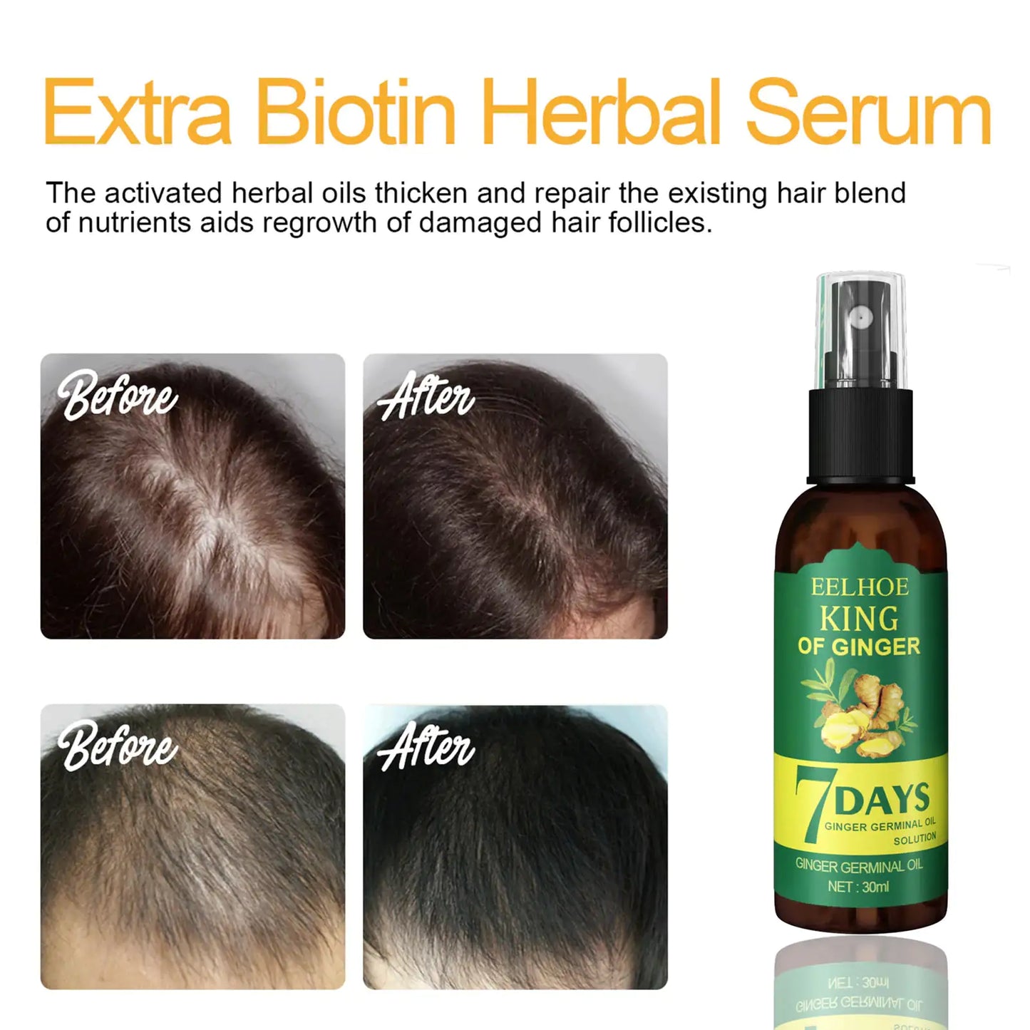 Ginger Hair Growth Serum