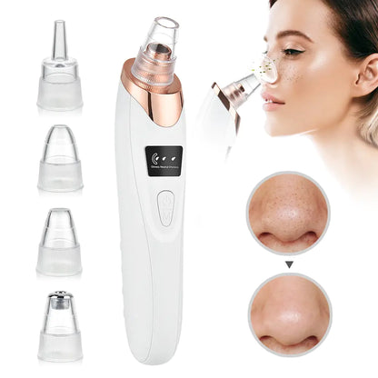 Beauty Electric Blackhead Remover